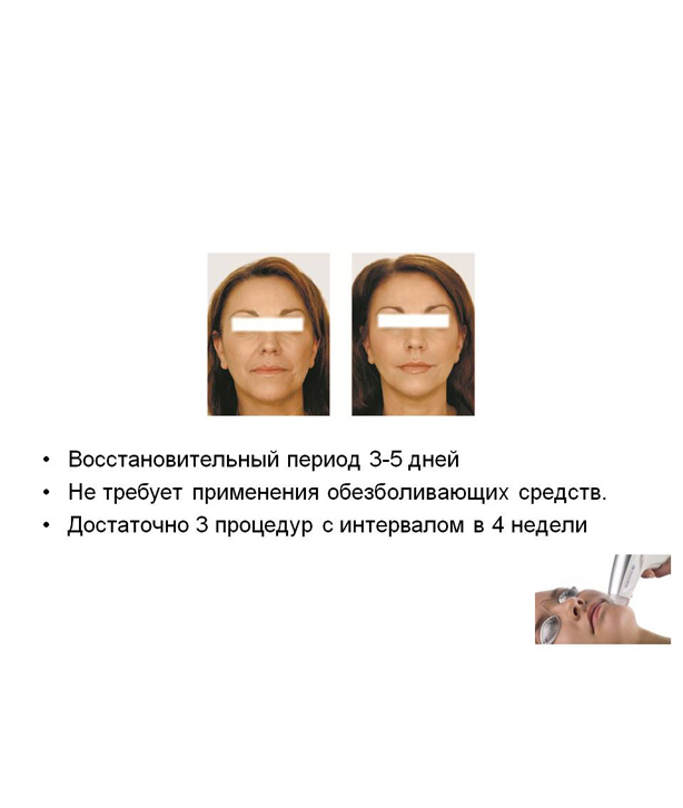 инканто4.jpg